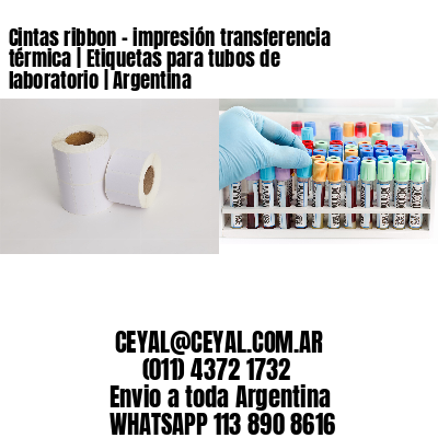 Cintas ribbon – impresión transferencia térmica | Etiquetas para tubos de laboratorio | Argentina